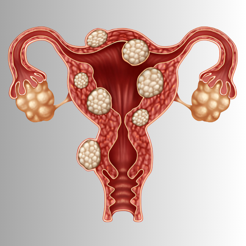 Untitled design (10)